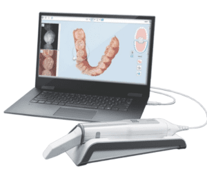 Revolutionize Your Practice with a FREE iTero™ IOS Digital Scanner ...